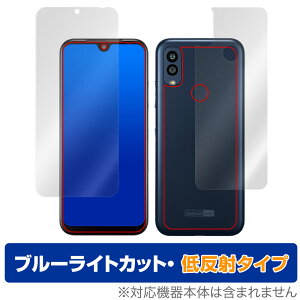 Android One S10 \ w tB Zbg OverLay Eye Protector ᔽ Z X}z Android One S10 u[CgJbg ˖h~