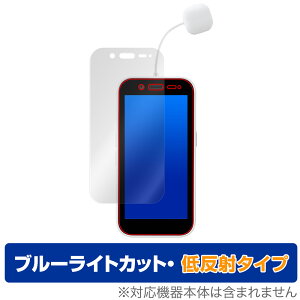 �\�t�g�o���N �L�b�Y�t�H��3 �ی� �t�B���� OverLay Eye Protector �ᔽ�� SoftBank �L�b�Y�t�H�� �X���[ �u���[���C�g�J�b�g ���˖h�~