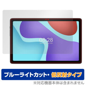 ALLDOCUBE iPlay 50 Pro ی tB OverLay Eye Protector ᔽ for I[hL[u iPlay50 v u[CgJbg ˖h~