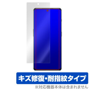 OnePlus Ace 2 �ی� �t�B���� OverLay Magic for �����v���X �X�}�[�g�t�H�� �G�[�X 2 �t���ی� ���C�� �ώw�� �w��h�~ �R�[�e�B���O