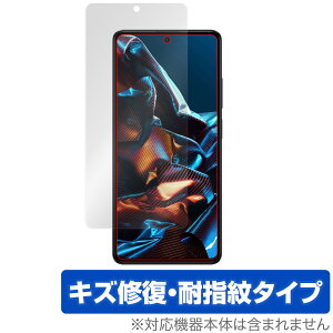 Xiaomi POCO X5 Pro 5G �ی� �t�B���� OverLay Magic for �V���I�~�[ �X�}�[�g�t�H�� �|�R X5 �v�� 5G �t���ی� ���C�� �ώw�� �w��h�~