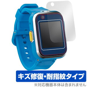 h ׂX}[gEHb` ی tB OverLay Magic X}[gEHb`gC tی C ώw wh~ R[eBO