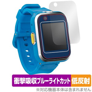 h ׂX}[gEHb` ی tB OverLay Absorber ᔽ X}[gEHb`gC Ռz ˖h~ R