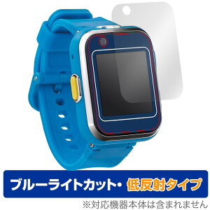 h ׂX}[gEHb` ی tB OverLay Eye Protector ᔽ X}[gEHb`gC u[CgJbg ˖h~