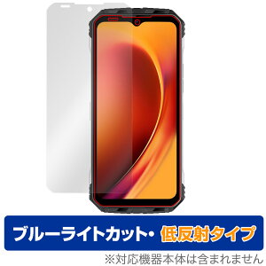 DOOGEE V Max �ی� �t�B���� OverLay Eye Protector �ᔽ�� for �h�D�[�W�[ �X�}�z V �}�b�N�X �t���ی� �u���[���C�g�J�b�g ���˖h�~