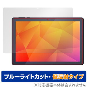 LUCA Tablet 10C` TE103M3N1-B یtB OverLay Eye Protector ᔽ J ^ubg TE103M3N1B u[CgJbg ˖h~