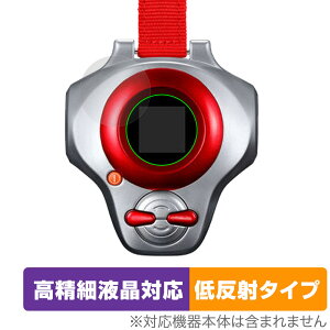 �f�W�����e�C�}�[�Y SuperCompleteSelectionAnimation �f�B�[�A�[�N �ی� �t�B���� OverLay Plus Lite �����׉t�� �A���`�O���A ���˖h�~