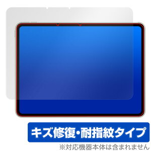 OPPO Pad 2 �ی� �t�B���� OverLay Magic for �I�b�| �^�u���b�g �I�b�|�p�b�h 2 �t���ی� ���C�� �ώw�� �w��h�~ �R�[�e�B���O