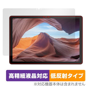 VANKYO MatrixPad S31X ی tB OverLay Plus Lite @LE }gbNXpbh ׉tΉ A`OA ˖h~