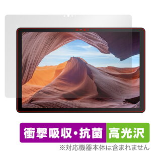 VANKYO MatrixPad S31X ی tB OverLay Absorber  @LE ^ubg }gbNXpbh Ռz  R