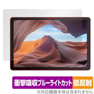VANKYO MatrixPad S31X ی tB OverLay Absorber ᔽ @LE ^ubg }gbNXpbh Ռz ˖h~ R