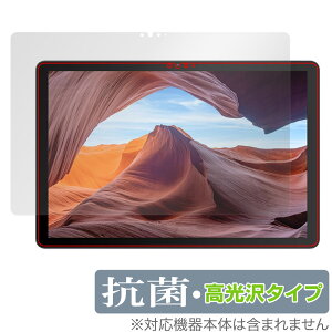 VANKYO MatrixPad S31X ی tB OverLay R Brilliant @LE ^ubg }gbNXpbh R RECX 