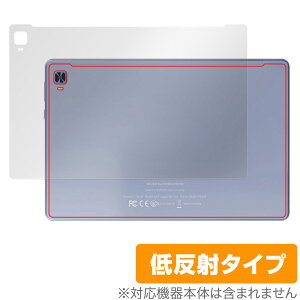 VANKYO MatrixPad S31X w یtB OverLay Plus @LE ^ubg }gbNXpbh {̕ی 炳Gᔽˑf