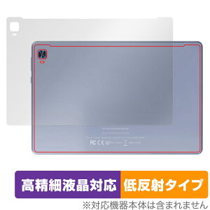 VANKYO MatrixPad S31X w ی tB OverLay Plus Lite @LE ^ubg }gbNXpbh 炳Gᔽˑf