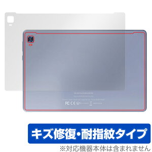 VANKYO MatrixPad S31X w ی tB OverLay Magic @LE ^ubg }gbNXpbh {̕ی C wh~