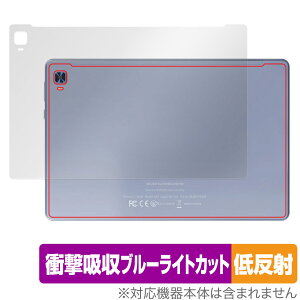 VANKYO MatrixPad S31X w ی tB OverLay Absorber ᔽ @LE ^ubg }gbNXpbh Ռz˖h~ R