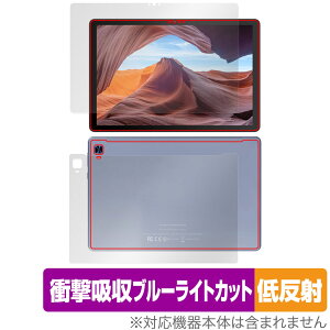 VANKYO MatrixPad S31X \ w tB Zbg OverLay Absorber ᔽ @LE }gbNXpbh Ռz ˖h~ R