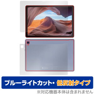 VANKYO MatrixPad S31X \ w tB Zbg OverLay Eye Protector ᔽ @LE }gbNXpbh u[CgJbg