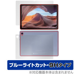VANKYO MatrixPad S31X \ w tBZbg OverLay Eye Protector 9H @LE }gbNXpbh dx u[CgJbg