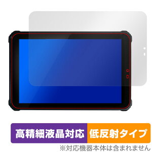 qPad mini DX KP11-OK ی tB OverLay Plus Lite NGpbh ~j DX KP11OK ׉tΉ A`OA ˖h~