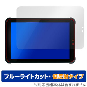 qPad mini DX KP11-OK ی tB OverLay Eye Protector ᔽ NGpbh ~j DX KP11OK u[CgJbg ˖h~