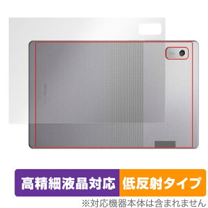 Lenovo Tab M9 �w�� �ی� �t�B���� OverLay Plus Lite ���m�{ Android �^�u���b�g �{�̕ی�t�B���� ���炳���G��ᔽ�ˑf��