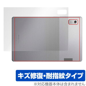 Lenovo Tab M9 w ی tB OverLay Magic m{ Android ^ubg {̕یtB C wh~ R[eBO