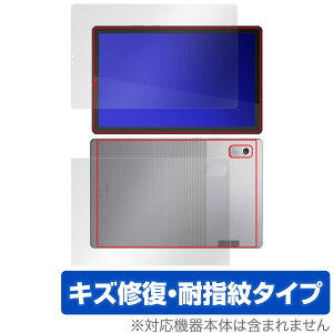 Lenovo Tab M9 �\�� �w�� �t�B���� OverLay Magic ���m�{ Android �^�u���b�g �\�ʁE�w�ʃZ�b�g ���C�� �ώw�� �w��h�~ �R�[�e�B���O