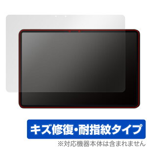 Xiaomi Pad 6 Pro / Pad 6 �ی� �t�B���� OverLay Magic �V���I�~�[ �^�u���b�g �V���I�~�[�p�b�h �t���ی� ���C�� �ώw�� �w��h�~