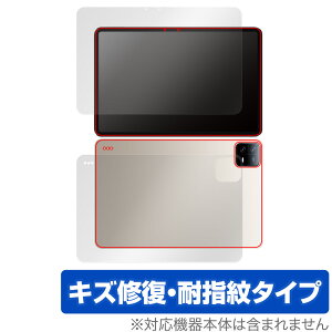 Xiaomi Pad 6 Pro / Pad 6 �\�� �w�� �t�B���� OverLay Magic �V���I�~�[ �^�u���b�g �\�ʁE�w�ʃZ�b�g ���C�� �ώw�� �w��h�~