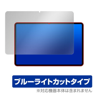 Teclast T40S ی tB OverLay Eye Protector for eNXg T40S ^ubg tی ڂɗD u[CgJbg