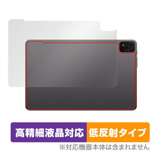 Teclast T40S �w�� �ی� �t�B���� OverLay Plus Lite for �e�N���X�g T40S �^�u���b�g �{�̕ی�t�B���� ���炳���G��ᔽ�ˑf��