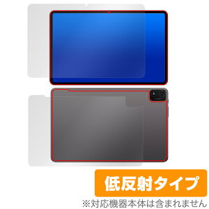 Teclast T40S �\�� �w�� �t�B���� OverLay Plus for �e�N���X�g T40S �^�u���b�g �\�ʁE�w�ʃZ�b�g �A���`�O���A ���˖h�~ �w��h�~