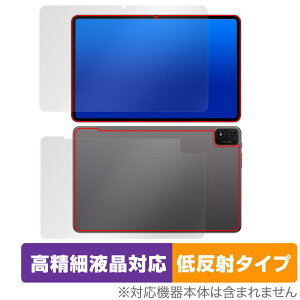 Teclast T40S �\�� �w�� �t�B���� �Z�b�g OverLay Plus Lite �e�N���X�g T40S �^�u���b�g �����׉t���Ή� �A���`�O���A ���˖h�~ �w��h�~