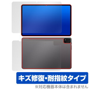 Teclast T40S �\�� �w�� �t�B���� OverLay Magic for �e�N���X�g T40S �^�u���b�g �\�ʁE�w�ʃZ�b�g ���C�� �ώw�� �w��h�~ �R�[�e�B���O