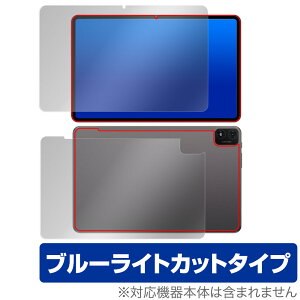 Teclast T40S \ w tB OverLay Eye Protector eNXg T40S ^ubg \ʁEwʃZbg ڂɗD u[CgJbg
