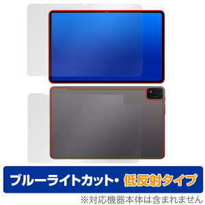 Teclast T40S \ w tB Zbg OverLay Eye Protector ᔽ for eNXg T40S ^ubg u[CgJbg ˖h~