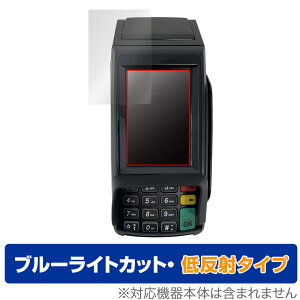 ���u�^�}���`���ϒ[�� CASTLES VEGA3000 Countertop V3C Touch �ی� �t�B���� OverLay Eye Protector �ᔽ�� �u���[���C�g�J�b�g ���˖h�~