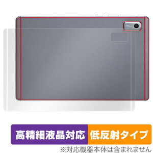 LAVIE Tab T9 T0975/GAS TAB09/H01 TAB09/H02 9^ 2023N6 w ی tB OverLay Plus Lite {̕ی 炳Gᔽ