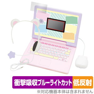 wbhZbgł͂HI ݂R炵p\RMYLIVE یtB OverLay Absorber ᔽ Ռz ˖h~ u[CgJbg