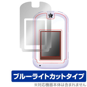 J[hłI݂R炵Phone with U ی tB OverLay Eye Protector tی ڂɗD u[CgJbg