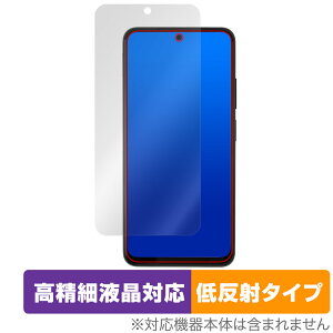 Xiaomi Redmi Note 11S / 11 保護 フィルム OverLay Plus Lite シャオミー スマホ レドミ ノート 高精細液晶対応 アンチグレア 反射防止