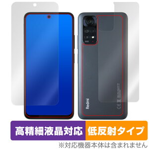 Xiaomi Redmi Note 11S 11 \ wʃZbg tB OverLay Plus Lite VI~[ h~ m[g ׉tΉ A`OA ˖h~