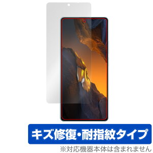 Xiaomi POCO F5 �ی� �t�B���� OverLay Magic �V���I�~�[ �X�}�z �|�R �V���[�Y �t���ی� ���C�� �ώw�� �w��h�~ �R�[�e�B���O