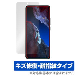 Xiaomi POCO F5 Pro ی tB OverLay Magic VI~[ X}z |R V[Y tی C ώw wh~ R[eBO