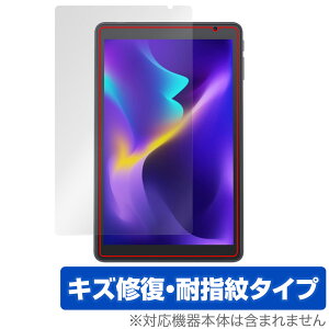 VANKYO MatrixPad S8X �ی� �t�B���� OverLay Magic ���@���L���E �^�u���b�g �}�g���b�N�X�p�b�h �t���ی� ���C�� �ώw�� �w��h�~