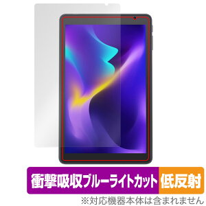 VANKYO MatrixPad S8X �ی�t�B���� OverLay Absorber �ᔽ�� �^�u���b�g �}�g���b�N�X�p�b�h �Ռ��z�� ���˖h�~ �u���[���C�g�J�b�g �R��