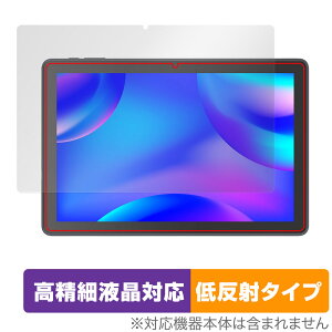 VANKYO MatrixPad S10X ی tB OverLay Plus Lite ^ubg }gbNXpbh tی ׉tΉ A`OA ˖h~