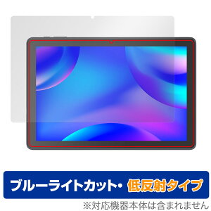 VANKYO MatrixPad S10X ی tB OverLay Eye Protector ᔽ ^ubg }gbNXpbh u[CgJbg ˖h~