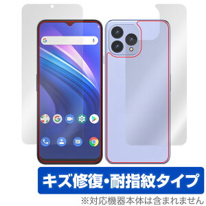 Cubot P80 �\�� �w�� �t�B���� OverLay Magic for �L���[�{�b�g �X�}�[�g�t�H�� �\�ʁE�w�ʃZ�b�g ���C�� �ώw�� �w��h�~ �R�[�e�B���O